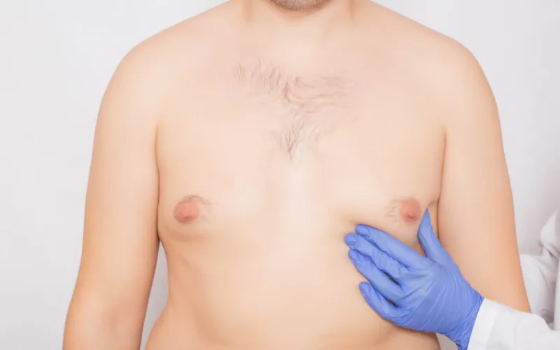 Ginecomastia Chirurgia Fabjan Italia