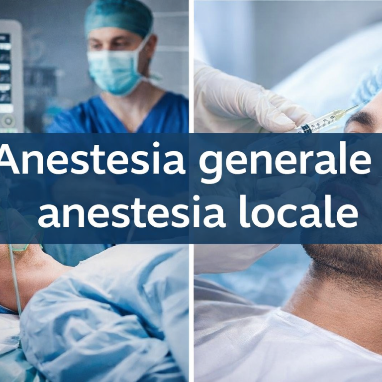ANESTESIA GENERALE VS. ANESTESIA LOCALE