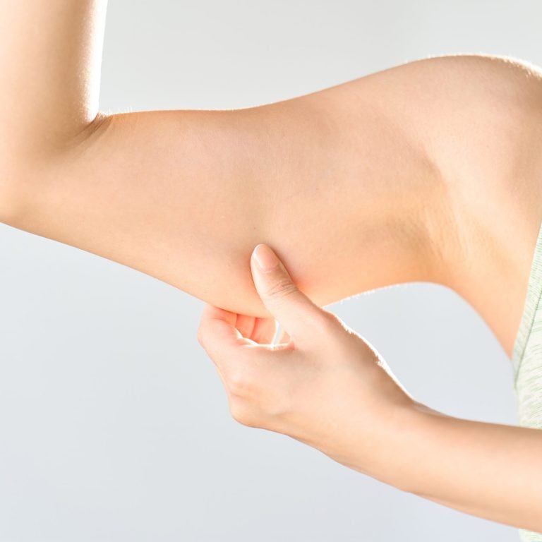 A woman stretching her upper arms