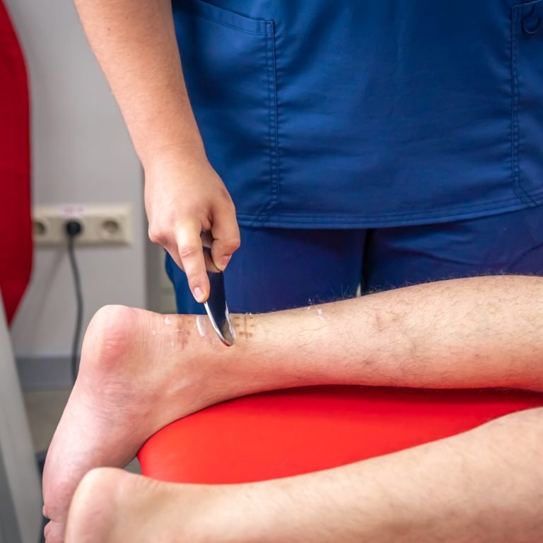 Heel and arch pain treatment with Instrument Assisted Soft Tissue Mobilization IASTM.