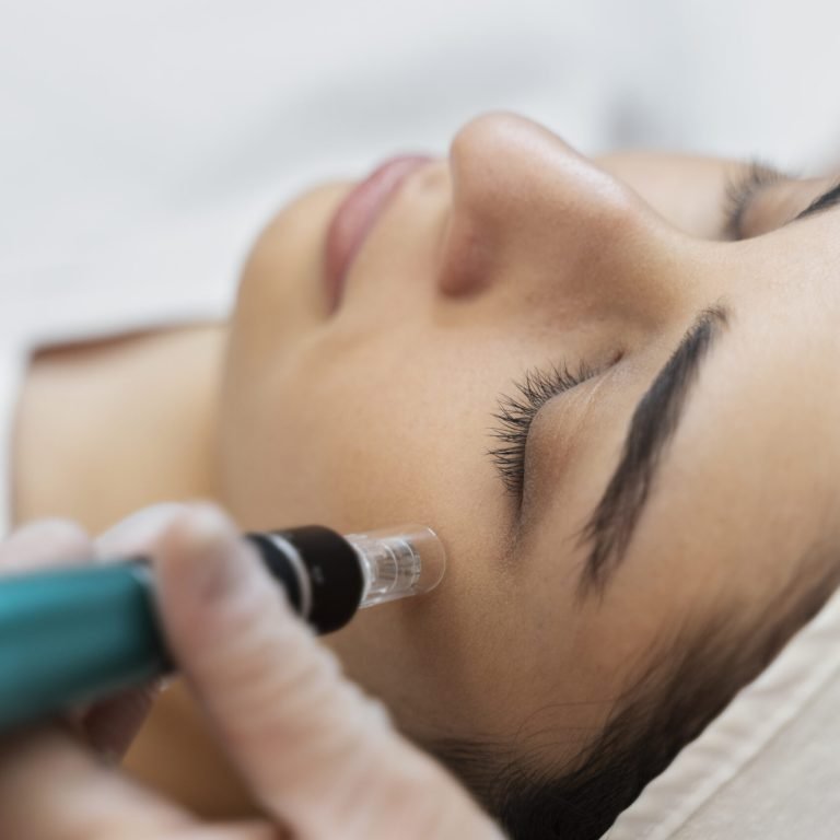 person-getting-micro-needling-beauty-treatment